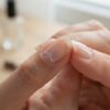 Le stylo blanc sous l&rsquo;ongle : une technique désuète