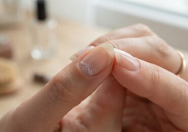 Le stylo blanc sous l&rsquo;ongle : une technique désuète
